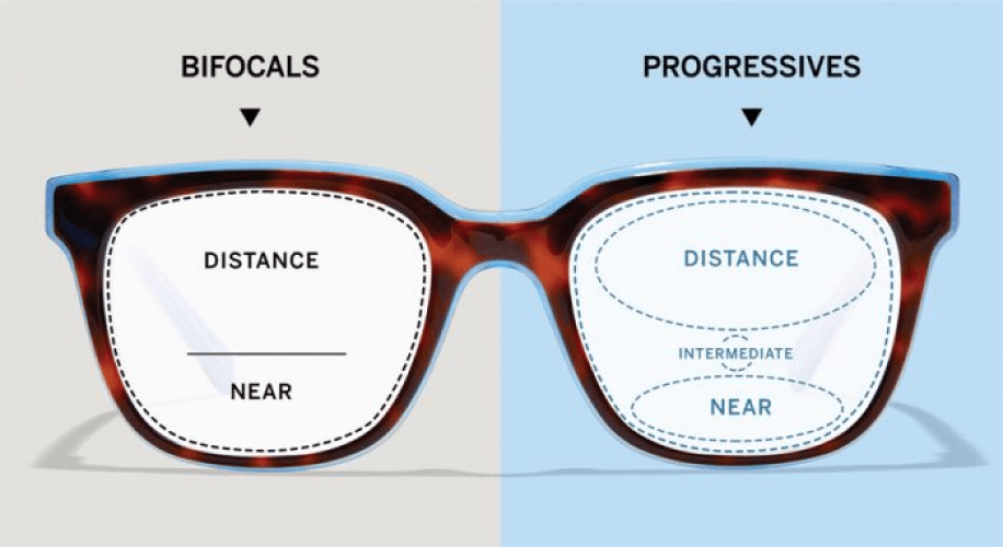 Progressives Vs Bifocals 