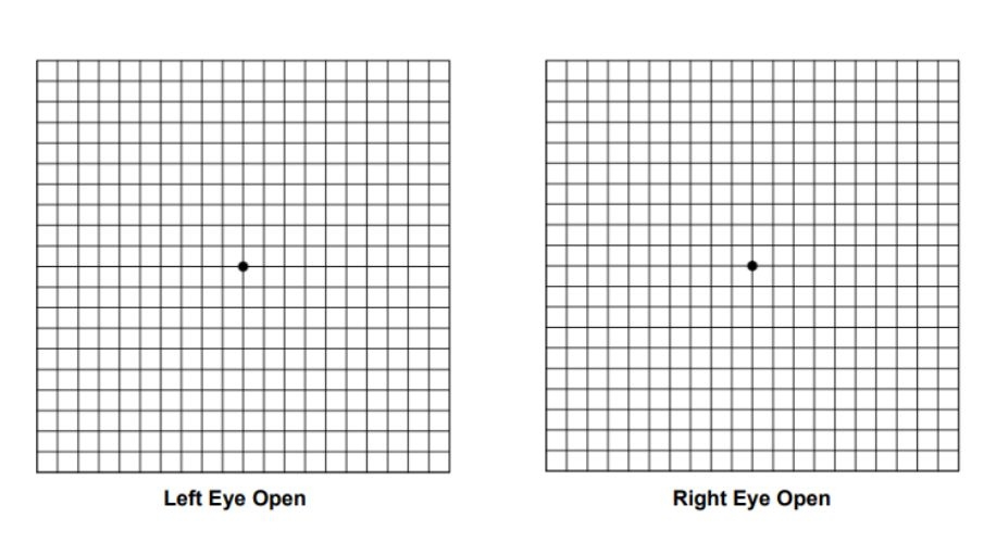 Left Eye Open and Right Eye Open Amsler grids, each with a black dot in the center.