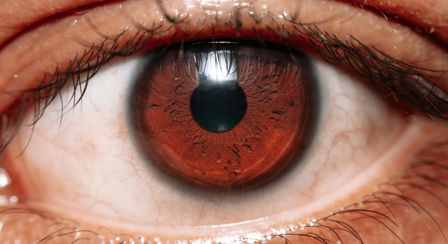 Close-up view of a human eye with a brown iris and prominent eyelashes.