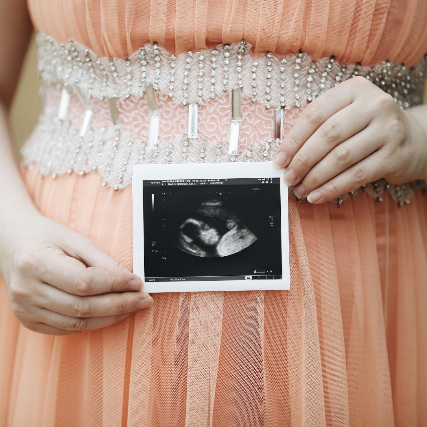 Ultrasound photo of a baby on a peach dress with silver embellishments.